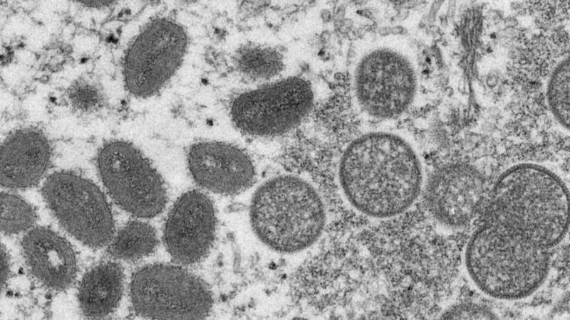 Biden Regime Stirring Fear Over Monkeypox, Warns More Cases to Come