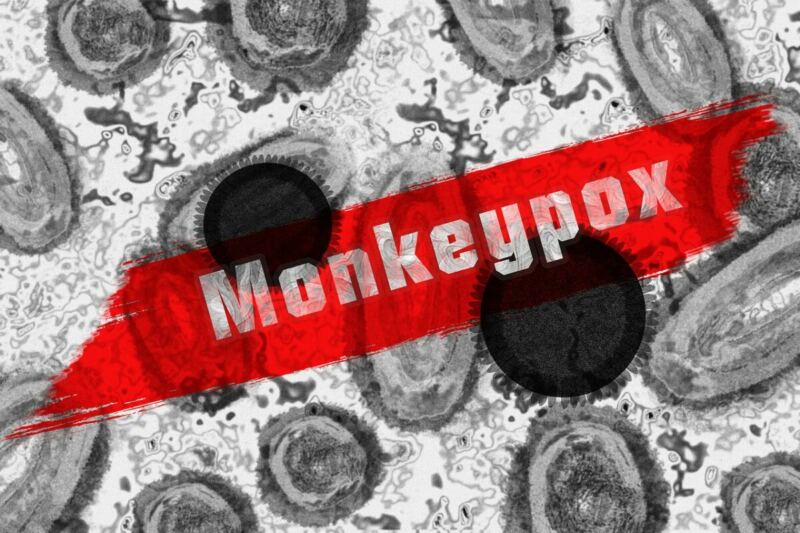 Two Cases of Monkeypox STD Reported in Children